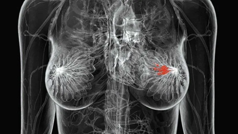 12fcb309d574fef4f53ee521d5fa59ef