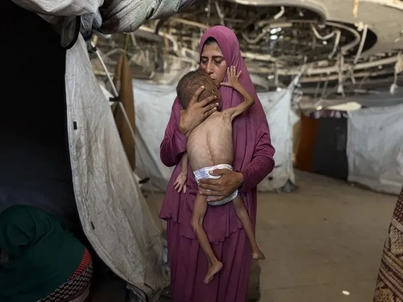 ONU confirma oficialmente la hambruna en la Franja de Gaza|Foto: EFE/Ahmad Awad