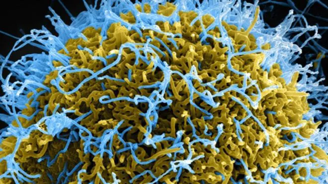 Cómo-las-Infecciones-de-transmisión-sexual-pueden-ser-beneficiosas