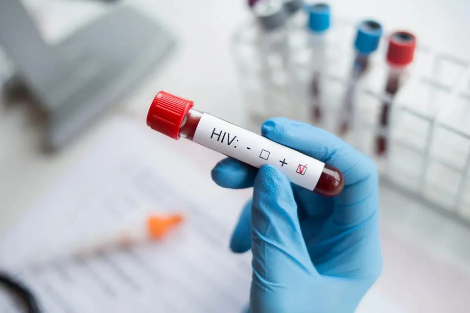 VIH - Prueba de sangre - enfermedad - salud
