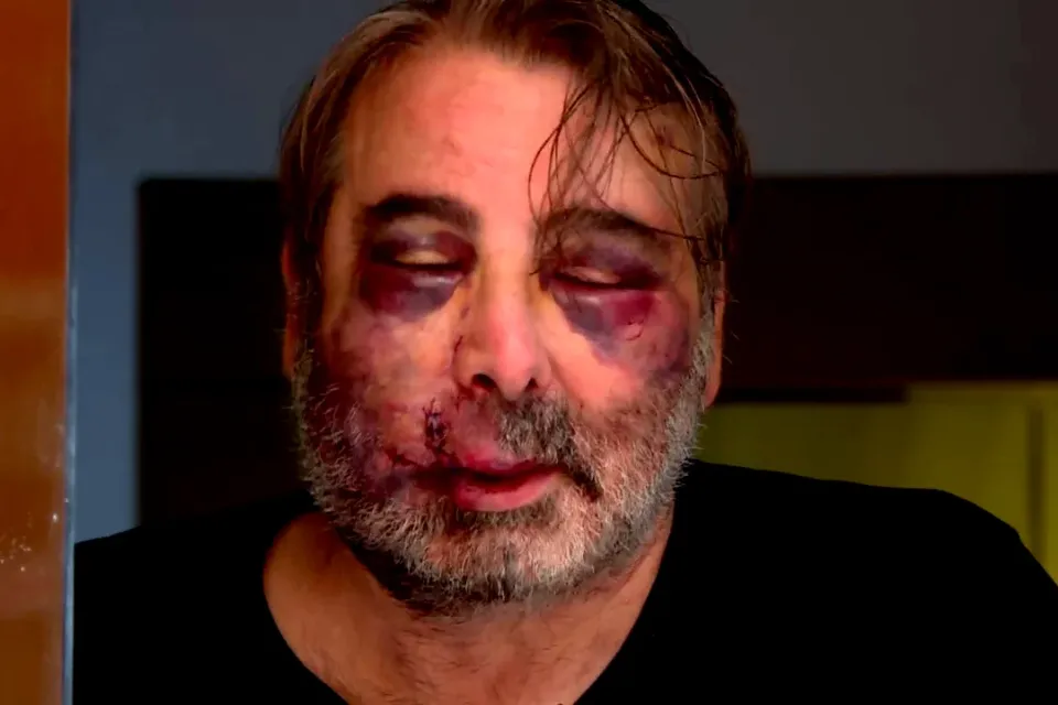 Golpiza a ciudadano en A Coruña