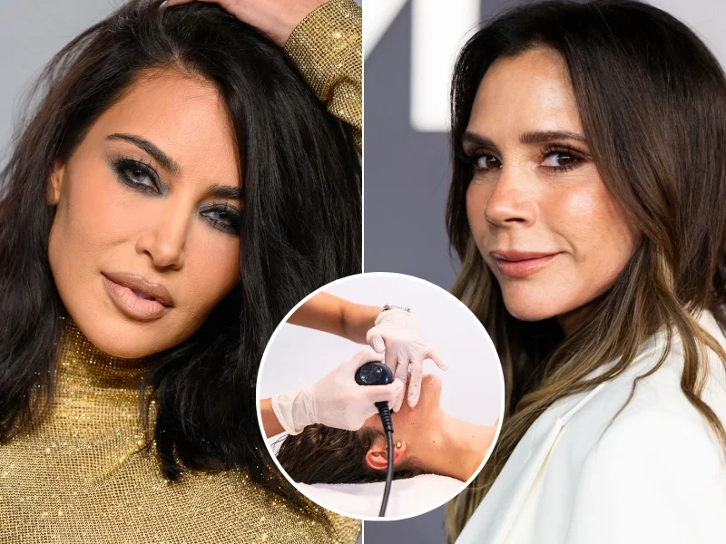 tratamiento-radiofrecuencia-microagujas-morpheus8-rostro-famosas