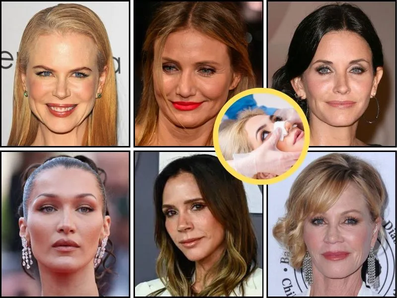 celebridades-arrepentidas-cirugia-plastica