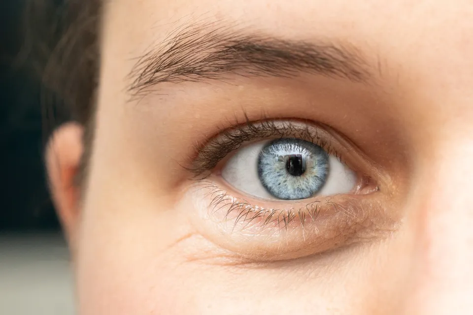 Bolsas de ojos Bolsas de ojos